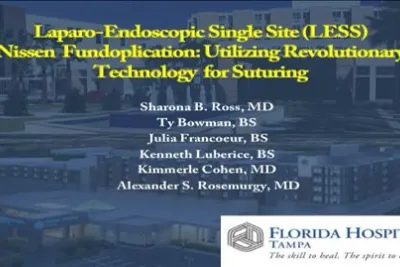 LESS Nissen Fundoplication Utilizing Revolutionary Technology for Suturing.