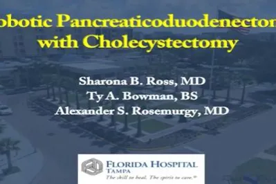 Robotic Pancreaticoduodenectomy with Cholecystectomy