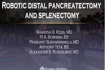 Robotic Distal Pancreatectomy and Splenectomy.