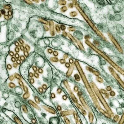 A microscopic image of H5N1 virus particles.