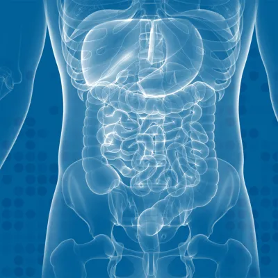 Graphic of a x-ray of an abdomen.