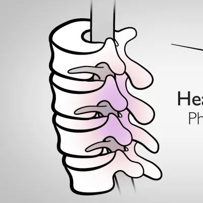 Pain Management Injections