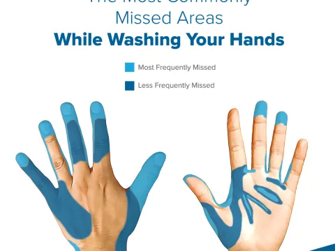 Social Media Graphic Available for Download of Commonly Missed Areas of Hand Washing