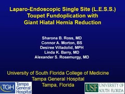 Laparo-Endoscopic Single Site (LESS) Toupet Fundoplication with Giant Hiatal Hernia Repair video thumbnail.