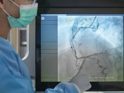 Doctor pointing at Coronary Angiogram during a procedure.