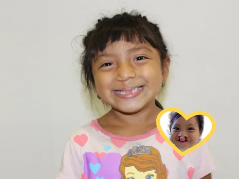 AdventHealth Sharing Smiles, Smile story Yoselin
