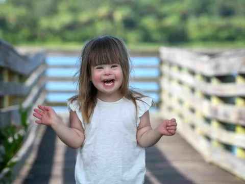 Luna Valle - AHFC Down Syndrome Patient