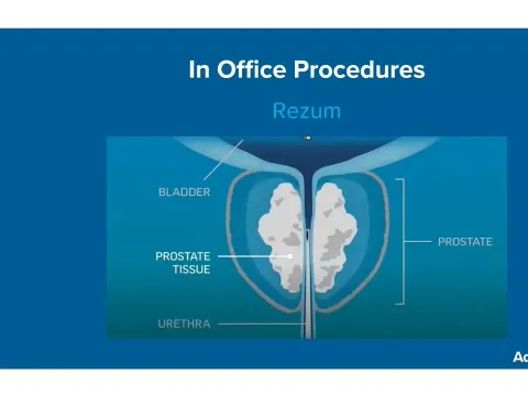 Men's Health Matters - Virtual Urology Event