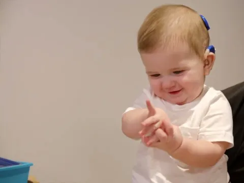 Baby Jack Hears His Parents Voices for the First Time with His Cochlear Implants
