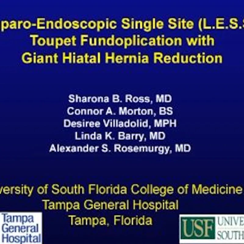 Laparo-Endoscopic Single Site (LESS) Toupet Fundoplication with Giant Hiatal Hernia Repair video thumbnail.