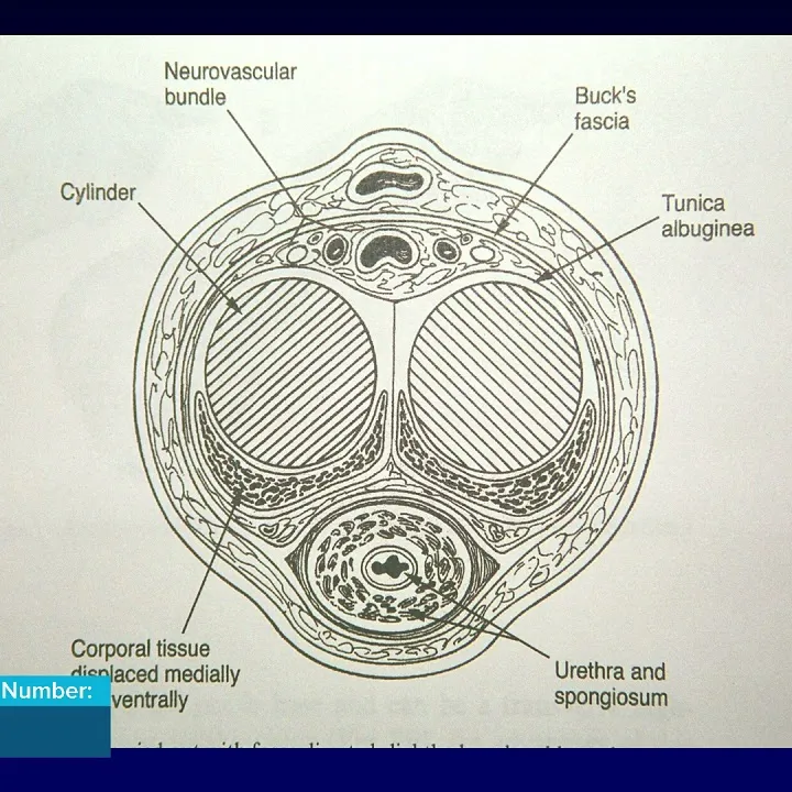 Urologic Abnormalities and Treatment Options for Complex Urologic Conditions